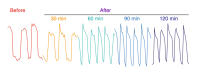 graph of beats of heart cells in a dish